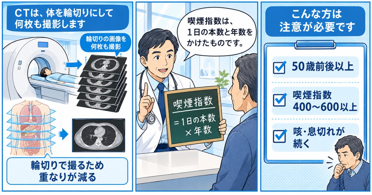 胸部CT検査を検討すべき具体的な判断基準と検診の選び方